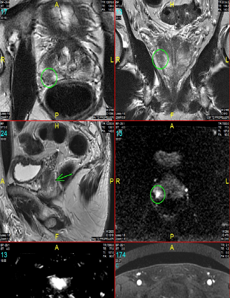 Images of a prostate MRI